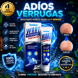 🌟 Wart Remover Ointment – Despídete de las Verrugas y Recupera tu Confianza