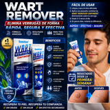 🌟 Wart Remover Ointment – Despídete de las Verrugas y Recupera tu Confianza