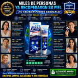 🌟 Wart Remover Ointment – Despídete de las Verrugas y Recupera tu Confianza