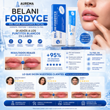 💙 BELANI FORDYCE – Labios Más Suaves, Hidratados y Libres de Imperfecciones